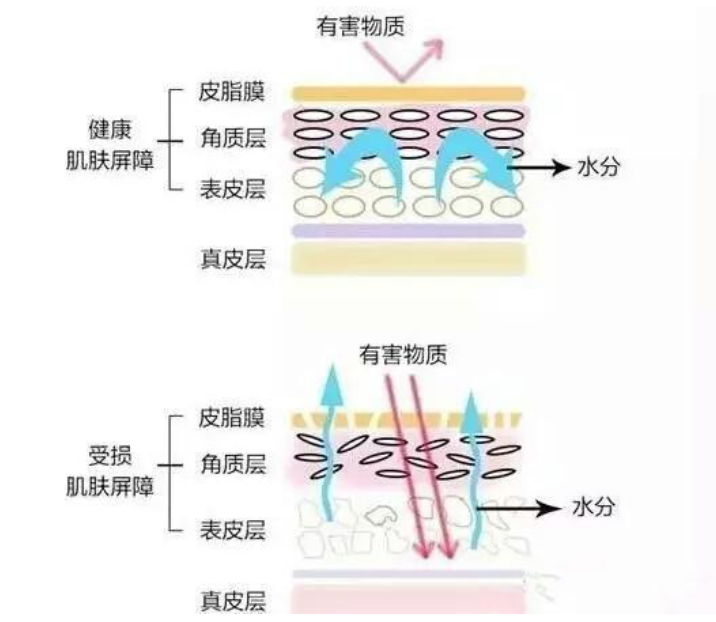 干、癢、紅、腫？別慌涂護膚品，先看看皮膚屏